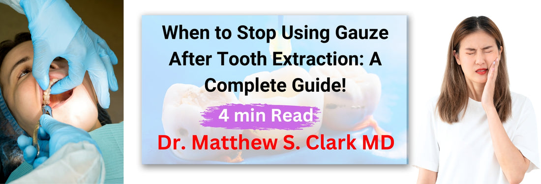 Close-up of gauze being used after tooth extraction to control bleeding