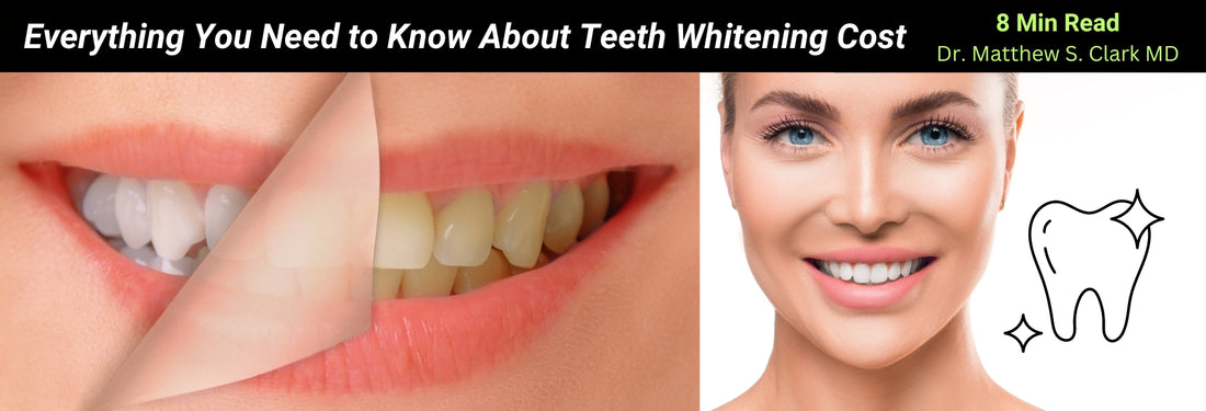 How Much Does Teeth Whitening Cost in 2024?